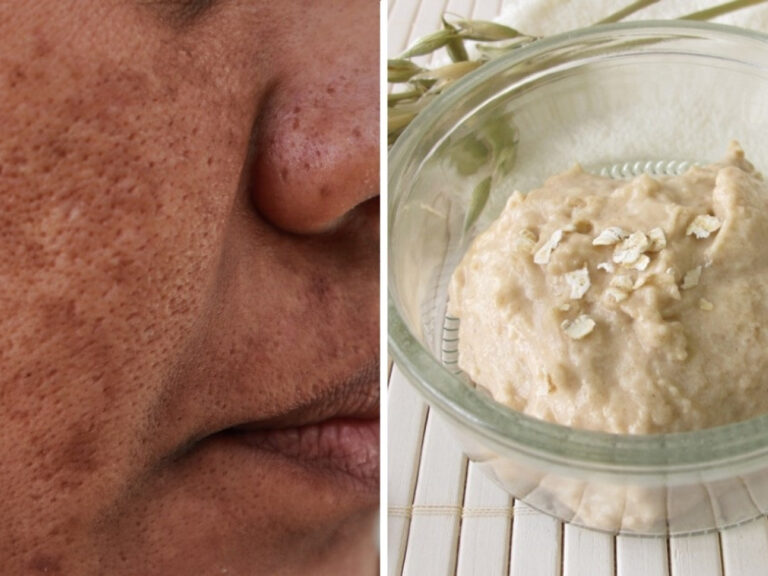 Aprende los beneficios de la crema de arroz para aclarar y rejuvenecer tu piel